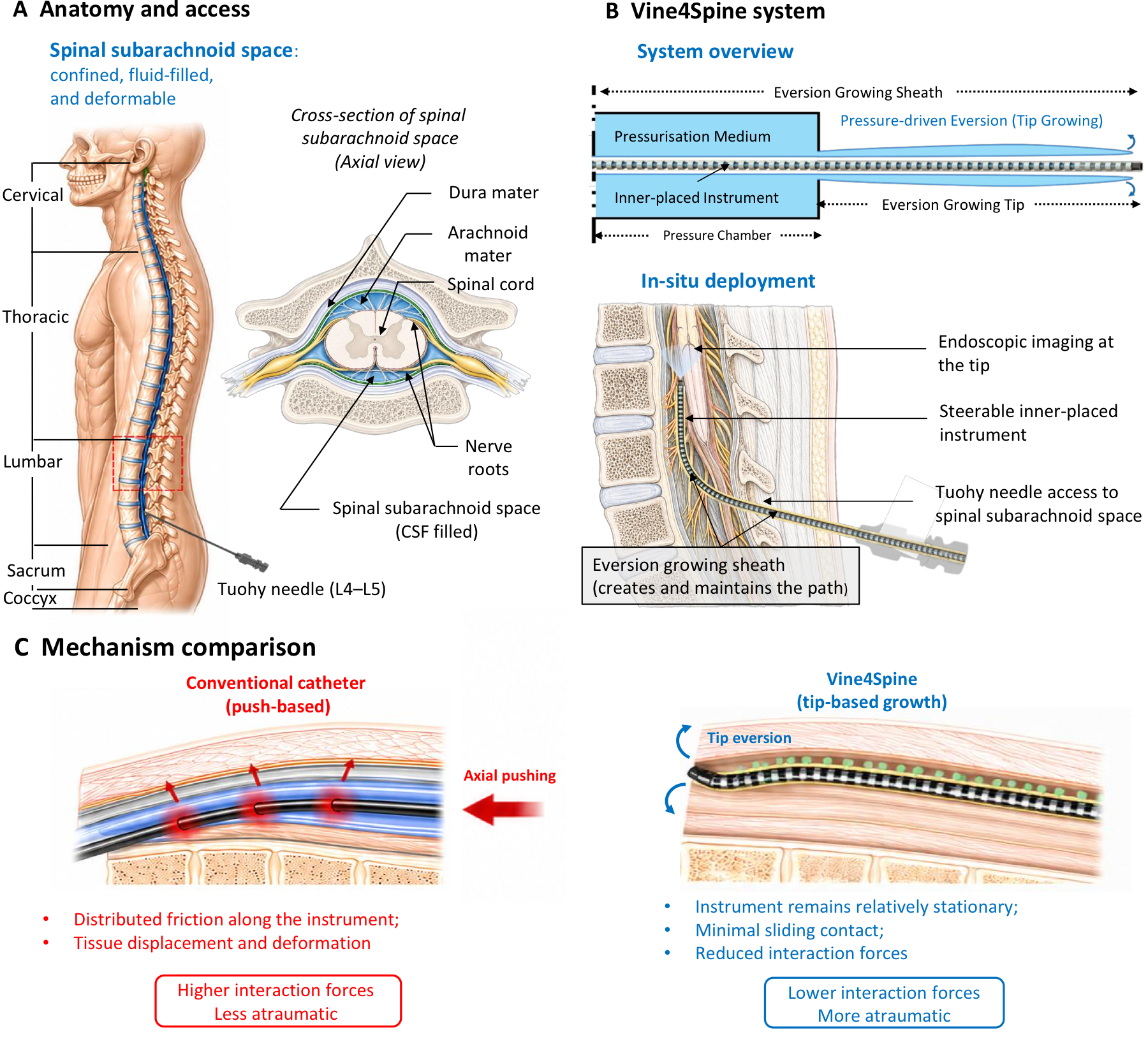 Vine4Spine anatomy, pressure-driven eversion mechanism, and comparison with a push-based catheter